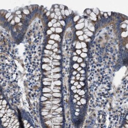GlyT1/SLC6A9 Antibody, Novus Biologicals:Antibodies:Primary Antibodies